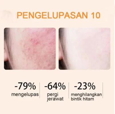 🔥Orange Enzyme Exfoliating Gel — The Gentle Your Skin Has Been Crying Out For