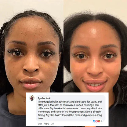 LOVILDS™ Collagen Night Wrapping Mask